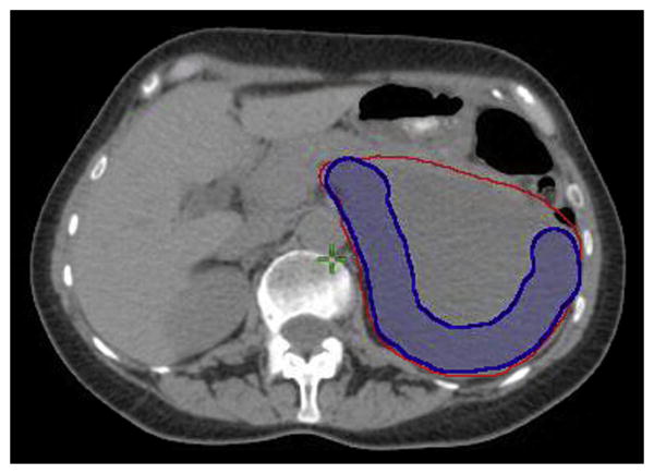 Fig. 1