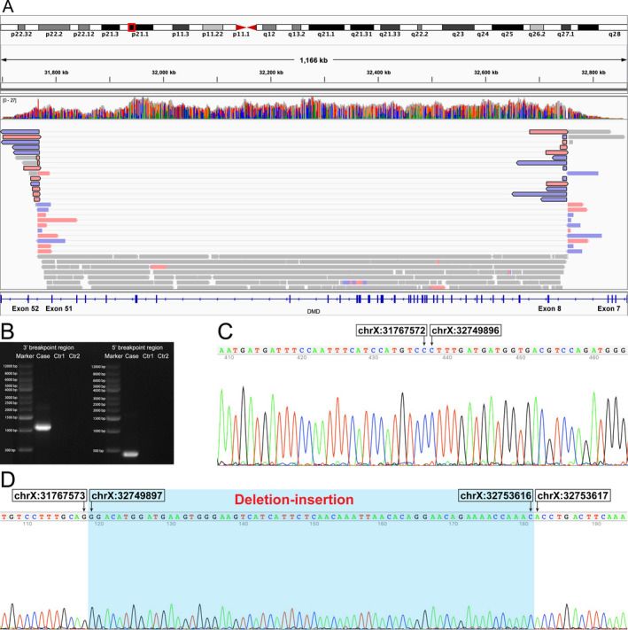 Figure 2