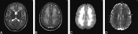 Fig 2.