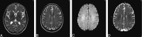 Fig 3.