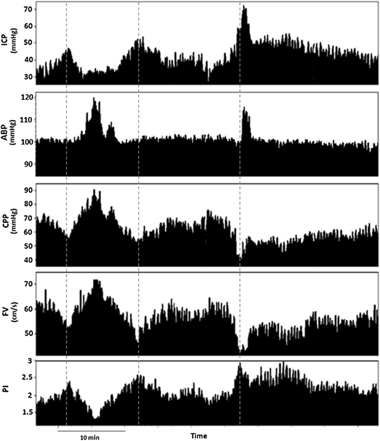 Fig. 2