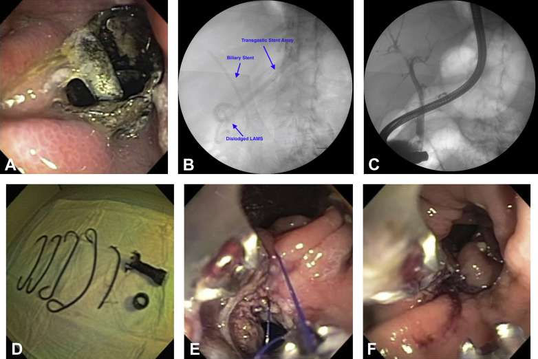 Figure 1