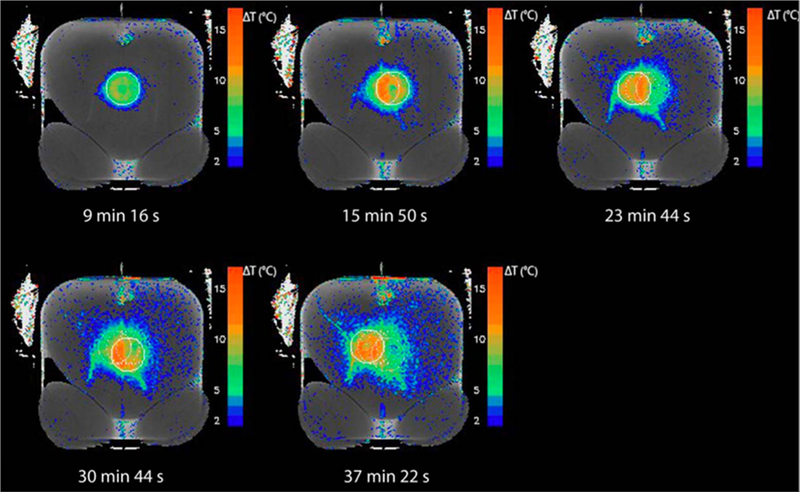 Fig. 13