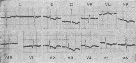 Text Fig. 2