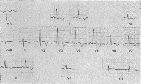 Text Fig. 6