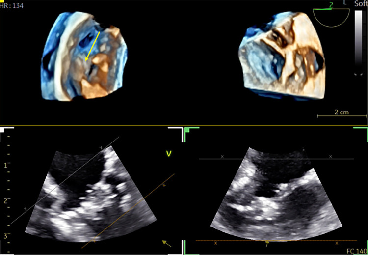 Figure 10