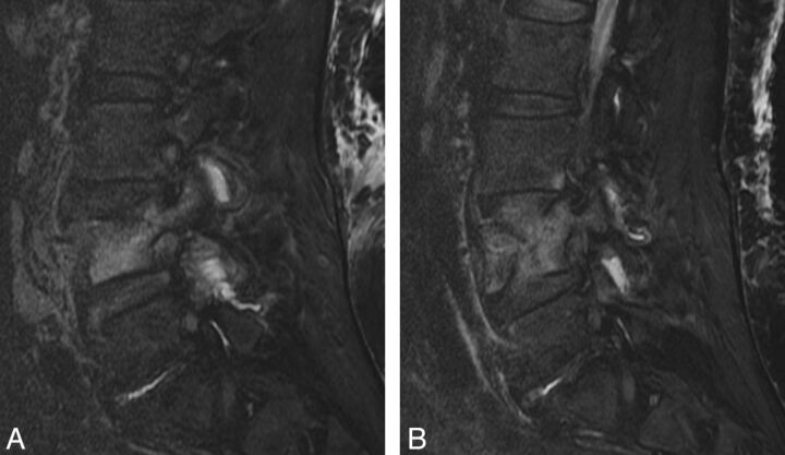 Fig 3.