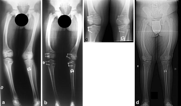 Fig. 4