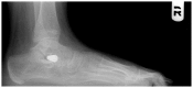 Figure 16