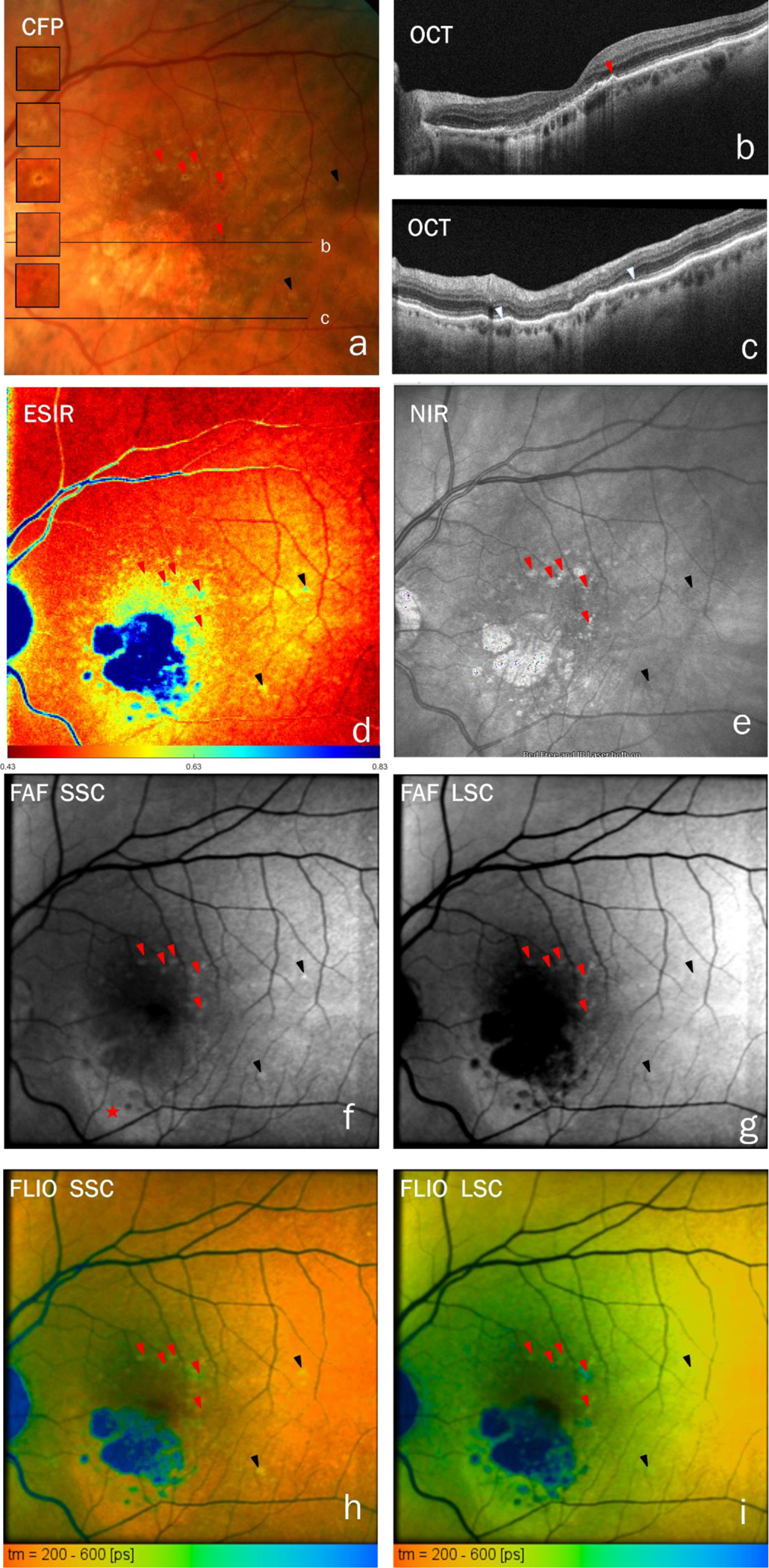 Fig. 3: