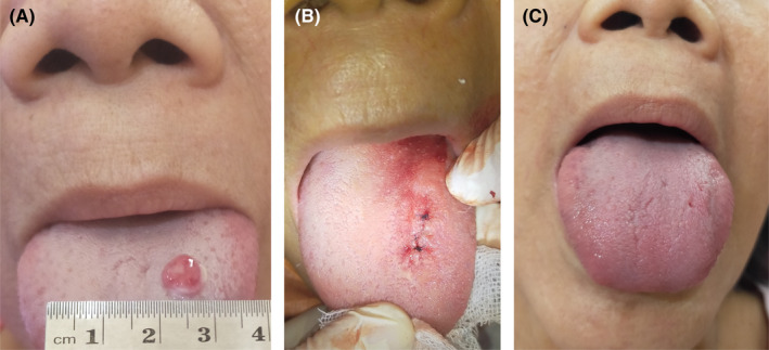 FIGURE 1