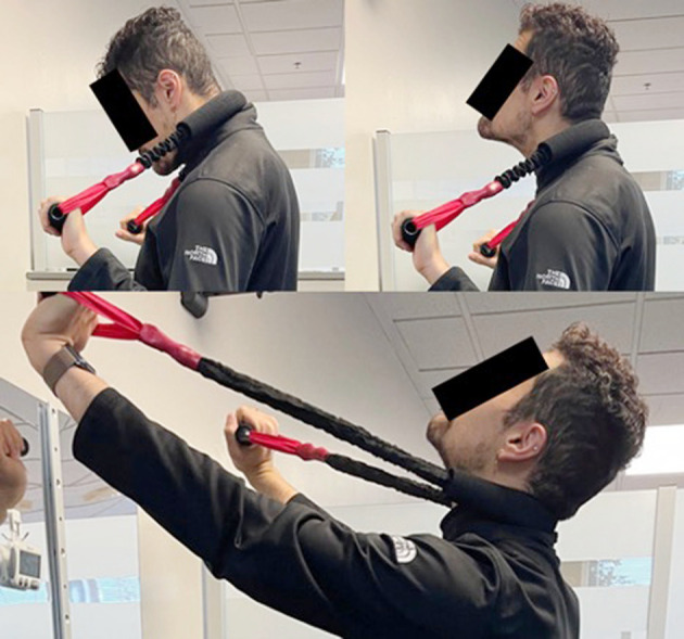Fig. 3.