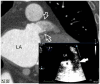 Figure 2A