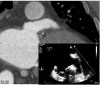 Figure 2B