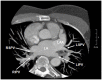 Figure 1A
