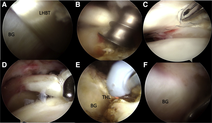 Fig 3