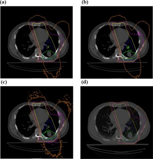 Figure 13