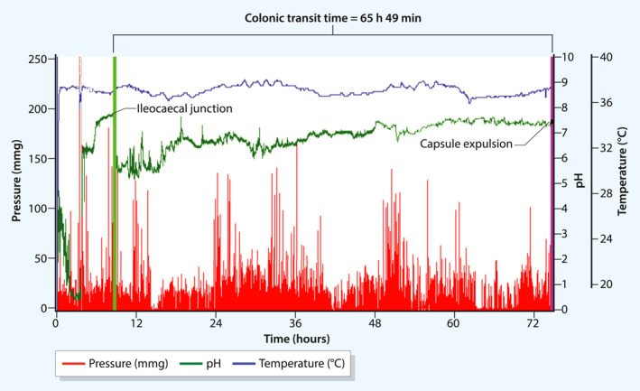 FIGURE 1