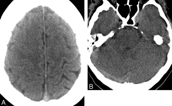 Fig 3.