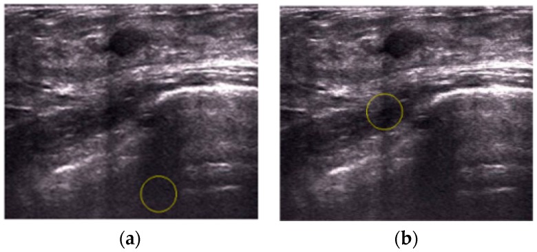 Figure 18