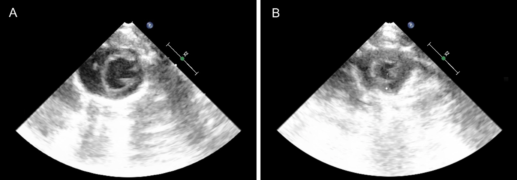 Figure 2: