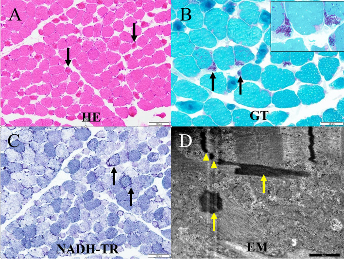 Fig. 2