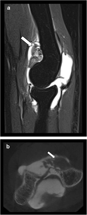 Fig. 12