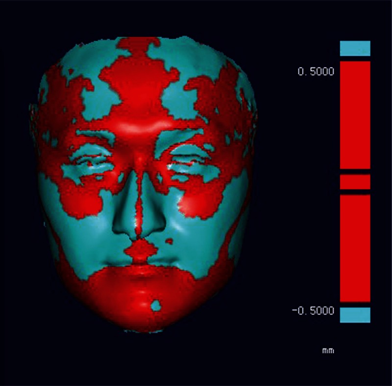 FIGURE 3