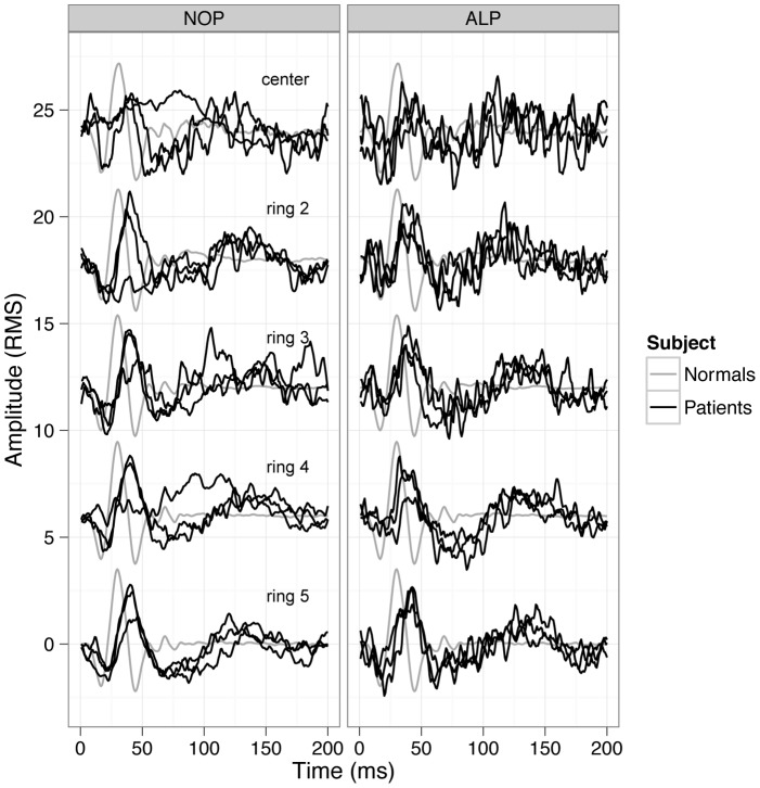 Figure 11