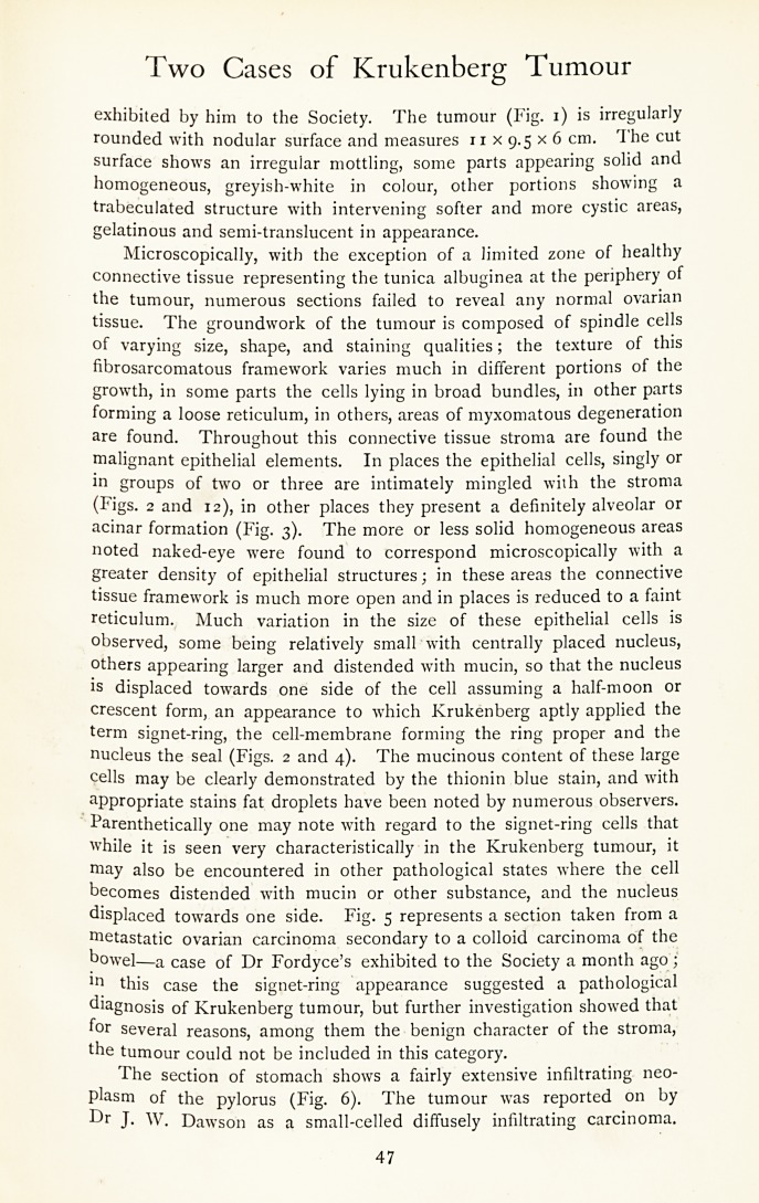 47