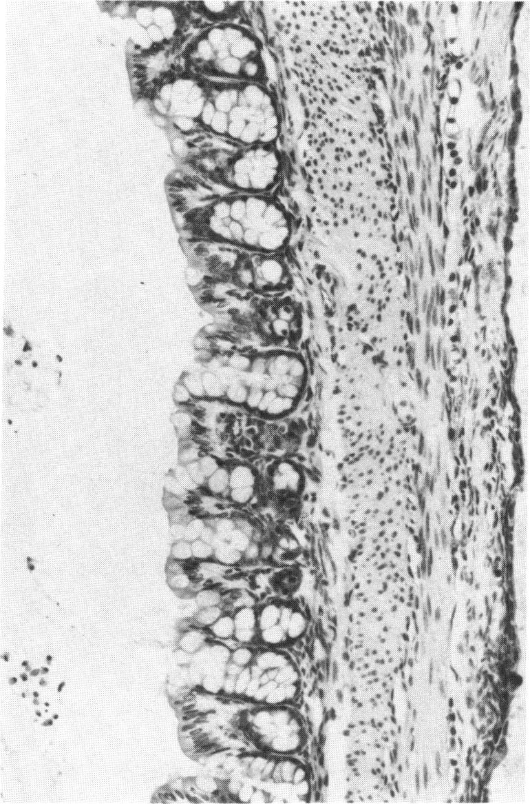 PLATE 27.