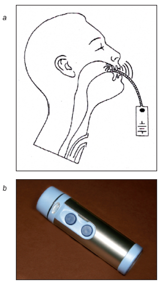 Figure 14