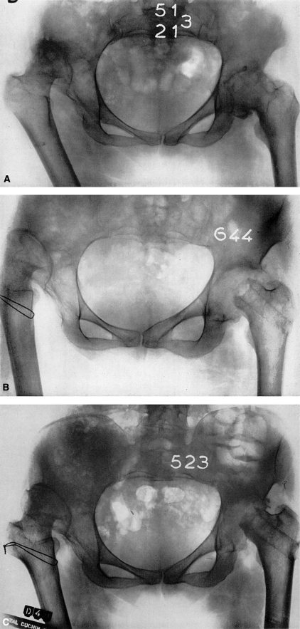 Fig. 15A–C