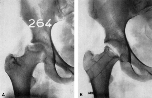 Fig. 17A–B