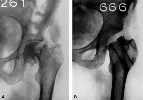 Fig. 13A–B