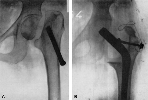 Fig. 12A–B