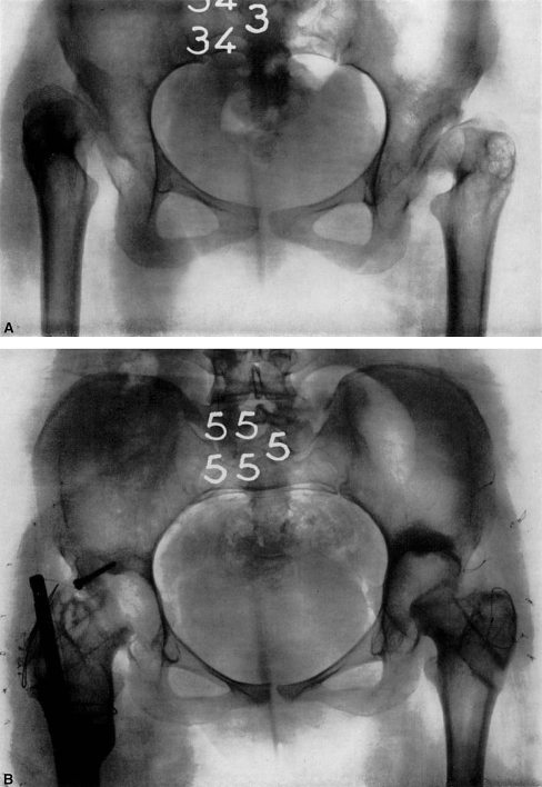 Fig. 5A–B