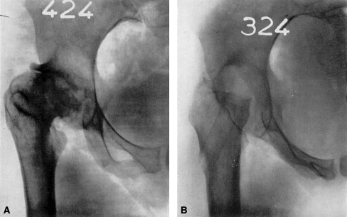 Fig. 1A–B 