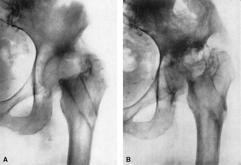 Fig. 14A–B