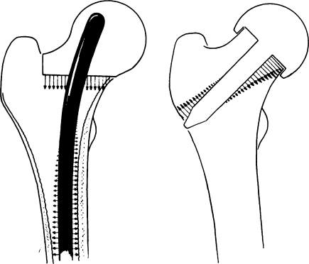 Fig. 16