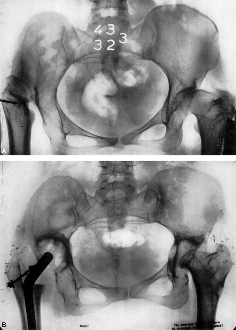 Fig. 6A–B