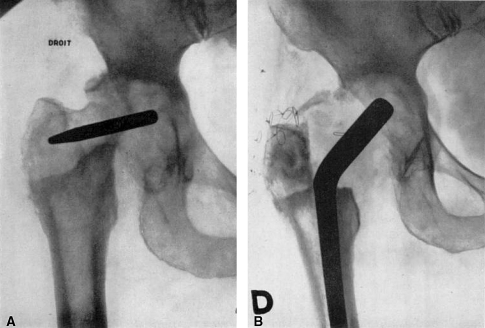 Fig. 18A–B