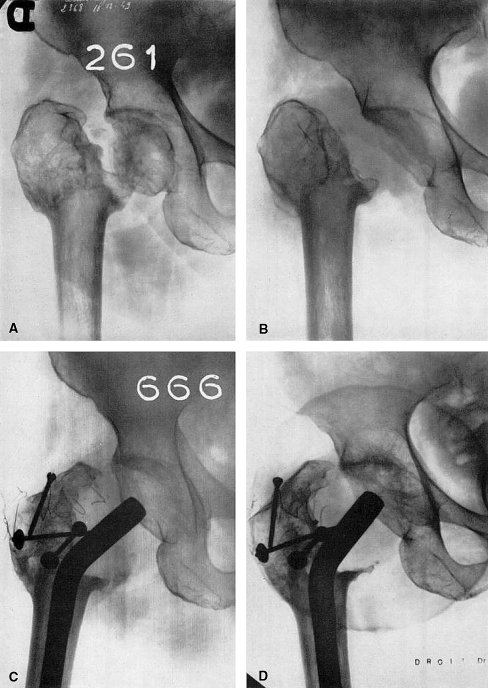 Fig. 11A–D