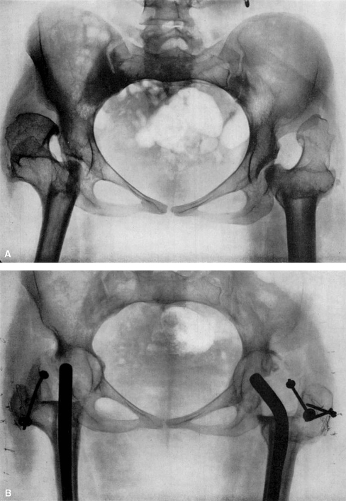 Fig. 8A–B