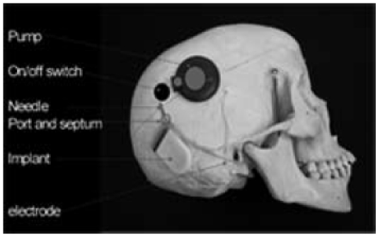 Figure 22