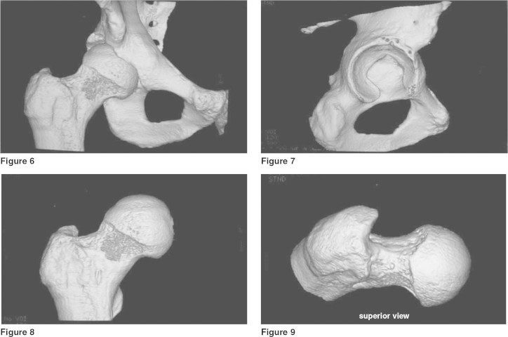 Figures 6, 7, 8 and 9