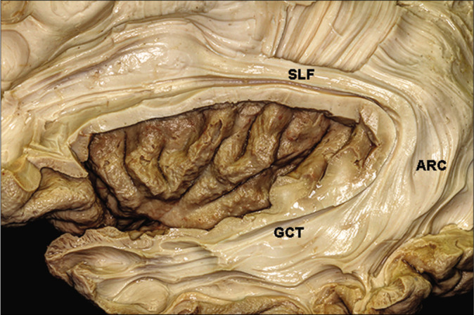 Figure 3: