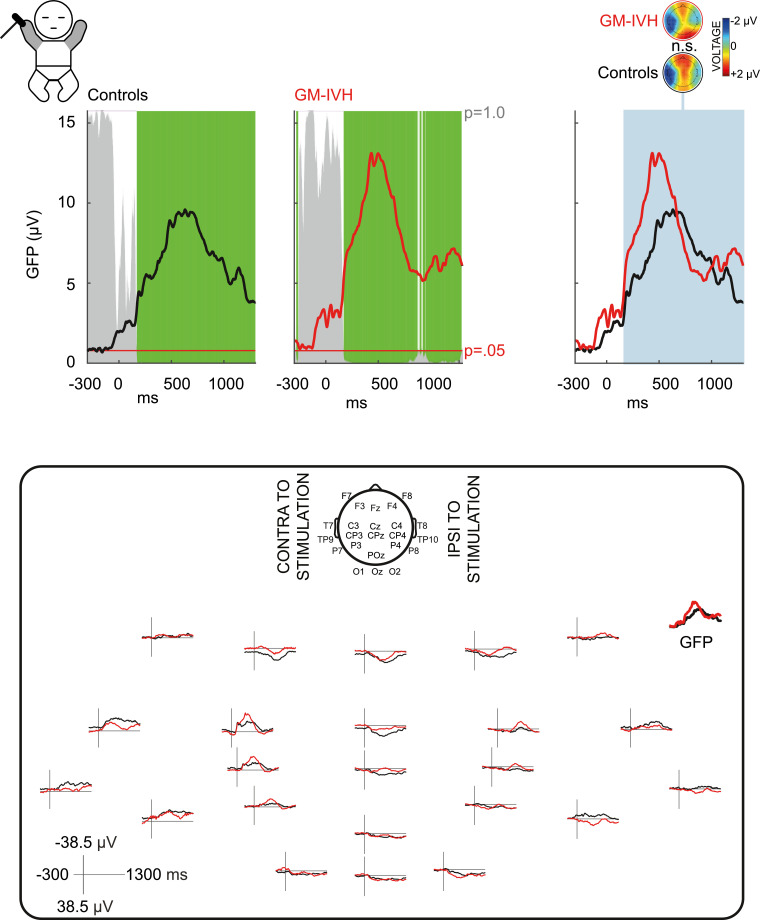 Fig 2: