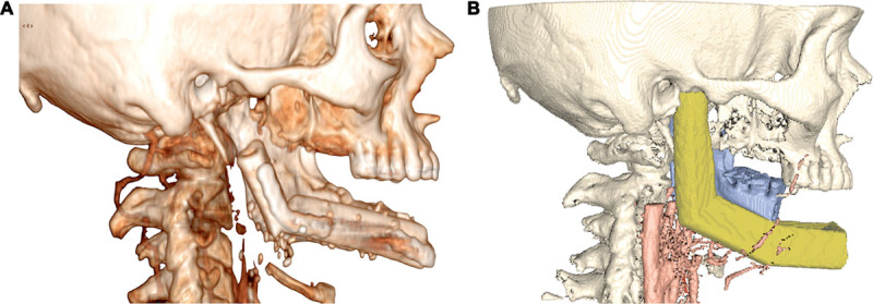 Fig. 5.