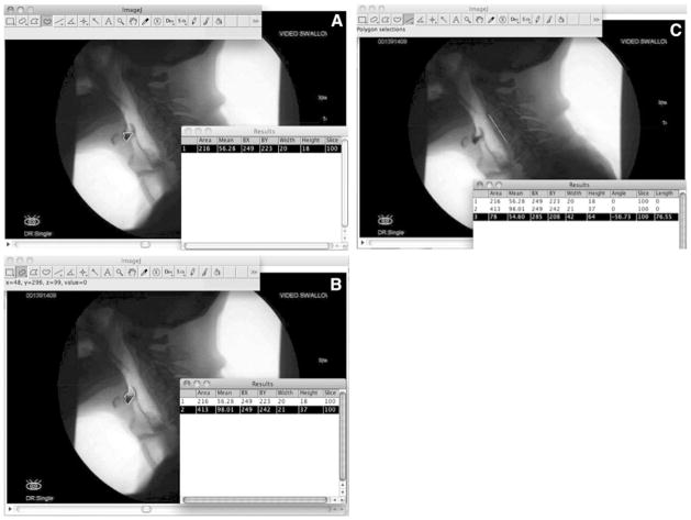 Fig. 3